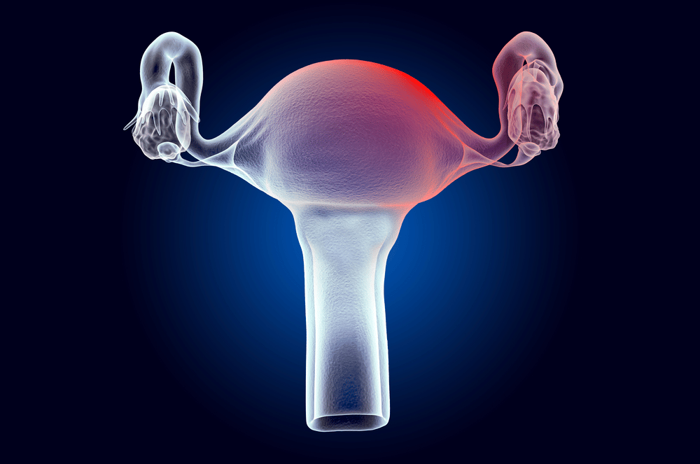 how-long-does-uterine-fibroid-embolization-take-north-texas-fibroids